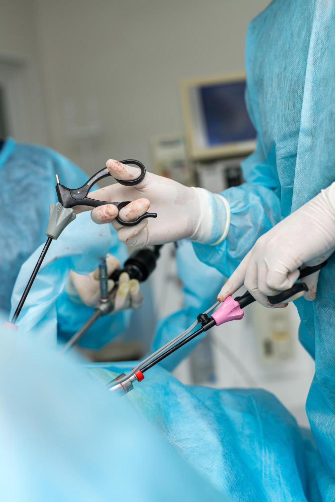 Preguntas frecuentes sobre el Cirujano General y de Trasplante en CDMX y Edo. Mex.